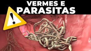 COMO ACABAR COM VERMES E PARASITAS no SEU CORPO  Dr Renato Silveira [upl. by Aziaf]