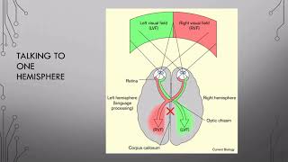 10 Hemispheric Specialization Pt 1 [upl. by Phiona527]