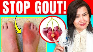 Do These 3 Things To Ease Gout at Home [upl. by Sheldon]