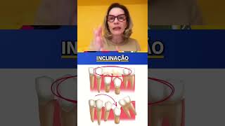 A IMPORTÂNCIA DO DENTE DECÍDUO NA ODONTOLOGIA  DRA MARA TAVARES [upl. by Emmery967]