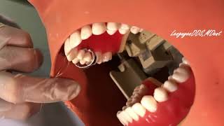 Perform dental rubber dam placement in the maxillary premolars [upl. by Lucretia318]