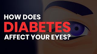 How Diabetes Affects Your Eyes Retinopathy Glaucoma Cataracts Macular Edema [upl. by Jeminah]