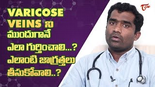 What Is Varicose Veins amp How Can It Be Treated   Dr Shailesh Kumar Garge  TeluguOne [upl. by Neelyam]