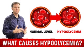 What Causes Hypoglycemia – DrBerg [upl. by Yedarb]