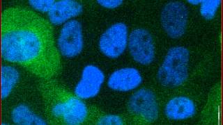 Mitotic catastrophe triggered in human cancer cells by the viral protein apoptin  movie A [upl. by Trellas664]