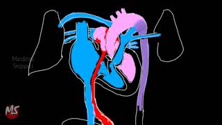 Fetal Circulation  Anatomy  Made easy  3 minutes [upl. by Essined316]