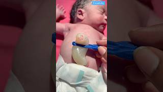 How Big Umbilical Cordmedical newbornbaby viralvideo [upl. by Dowell]