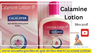 calamine lotion uses detail information Hindi MedTalks777 [upl. by Pass]