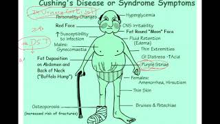 Cushing syndrome Dexamethasone suppression test explained [upl. by Assirhc]