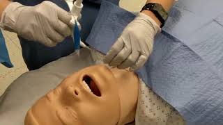 Surgical tracheostomy procedure [upl. by Rebna]