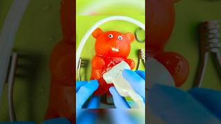 Gummy Surgery Fail😩💔🪦Satisfying Csection flatline DiscountDentist FruitSurgery FoodSurgery [upl. by Chari]