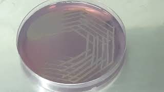 Stenotrophomonas maltophilia colony morphology on CLED agar [upl. by Stirling715]