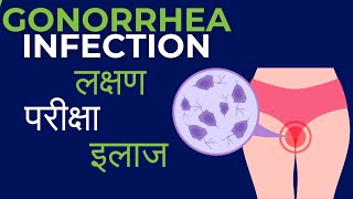 Gonorrhea symptoms in men  Gonorrhea kya hota hai  kaise hota hai  Diagnosis and treatment [upl. by Tor]