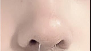 Small Nose tip 🎧 improved affirms [upl. by Richmal]