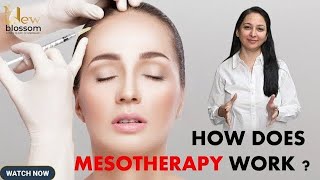 Mesotherapy for skin  How mesotherapy work [upl. by Senaj769]