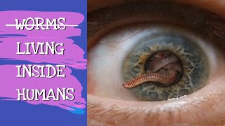 WORMS LIVING INSIDE HUMANS  EXPLAINED [upl. by Reisman]