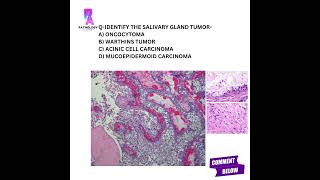 Histopathology questions histopathology mbbs md pathologyacademy draditikumar [upl. by Olgnaed]