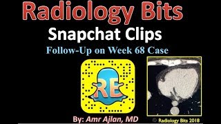 RADIOLOGY BITS SNAPCHAT WEEK 68 [upl. by Frolick]