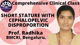 Short Stature with Cephalopelvic Disproportion Case Presentation [upl. by Eesdnyl]