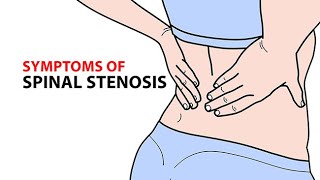 033 Learn Ten HomeBased Exercises and Pain Relief Positions for Lumbar Spinal Stenosis [upl. by Ellehcer]