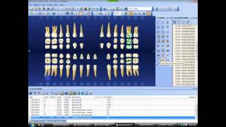 new pt in dentrix chart [upl. by Tenaej]