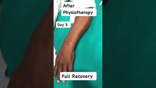 Flexor Contracture Recovery with Physiotherapy newsong punjabisong punjabi song [upl. by Buford159]