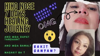 HIKO NOSE THREADLIFT  UPDATE 7 DAYS HEALING JOURNEY  Tips  Ano Dapat Gawin  Mga Dapat Iwasan [upl. by Waers832]