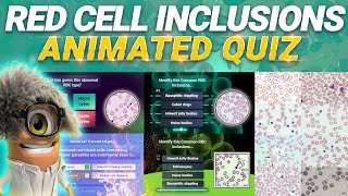 Identify RBC inclusions quiz with real microscopic images  rbc inclusions examples  rbc inclusion [upl. by Sirdi]