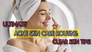 Ultimate Acne Skin Care Routine Clear Skin Tips [upl. by Xed10]