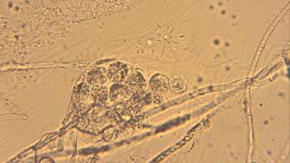 Releasing Oospores from Oogonium Oomycetes [upl. by Enisaj438]