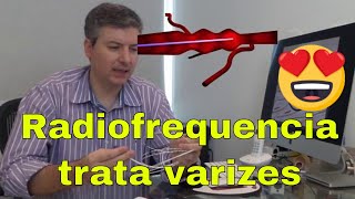 Tratando varizes com Radiofrequencia  Dr Alexandre Amato [upl. by Eihcir]