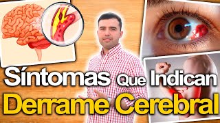 Ojo Con Estos Síntomas  Síntomas De Derrame Cerebral Y Cómo Prevenirlo Naturalmente [upl. by Eiral142]