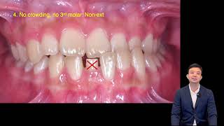 Treatment of Skeletal Class III malocclusion with selfligation system｜【Chris Chang Ortho】CC768 [upl. by Lahsiv239]