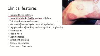 LeprosyHansens disease Pathogenesis Clinical features and treatment l USMLE [upl. by Auoz]