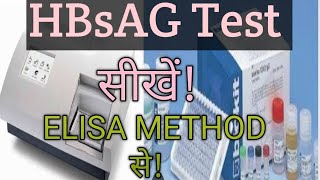 HBsAG Test in ELISA Method 🔥 HBsAG test elisa method se kese kare [upl. by Sokcin848]