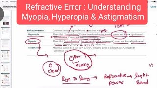 Refractive errors  Hyperopia Myopia astigmatism ophthalmology 3  First Aid USMLE Step 1 [upl. by Seligmann392]