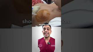 How Can You Fix A Dislocated Shoulder [upl. by Lleoj]