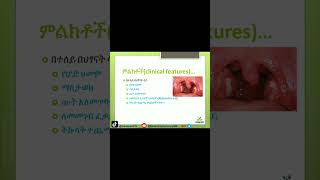 Tonsillitis Explained Symptoms Causes and Treatment Tonsillitis HealthTips የቶንሲልኢንፌክሽን [upl. by Westland]