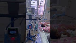 Newborn baby on ventilation in SNCUNICU sncu nicubaby nicu [upl. by Seabury]