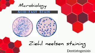 Ziehl Neelsen staining  Acid Fast staining microbiology 2ndyear BDS [upl. by Eidaj]