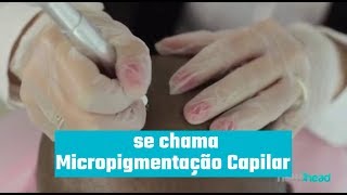 O que é Micropigmentação Capilar [upl. by Adniram]