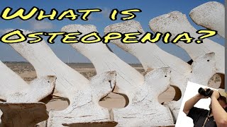 What is Osteopenia A brief description of what osteopenia and osteoporosis are [upl. by Green]