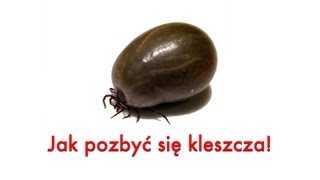 Kleszcz Poradnik jak usunąć kleszcza Wyjmowanie kleszcza [upl. by Emeline898]