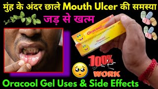 Oracool gel  Oracool gel kaise use kare  Oracool gel uses in hindi  Mouth ulcer treatment [upl. by Wallis]