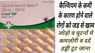 Celol D3 Plus Tablet Uses amp Dose  Calcium amp Vitamin D3  Healthy Bonnes Damage Nerve [upl. by Vanya706]