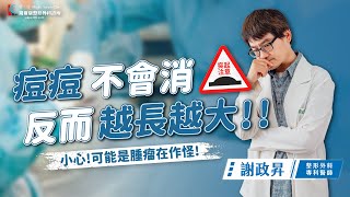 最新粉瘤手術衛教指南｜整形外科醫師詳細解說粉瘤治療方法！｜粉瘤手術｜表皮囊腫手術｜粉瘤切除手術｜ft謝政昇醫師 [upl. by Natelson]