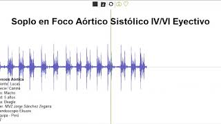 Soplo Eyectivo EA [upl. by Adlar503]