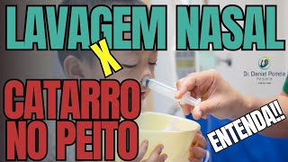 Lavagem nasal e catarro no peito como diferenciar [upl. by Zilada95]