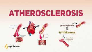 Atherosclerosis Physiology Pathophysiology and Pathogenesis [upl. by Kumagai]