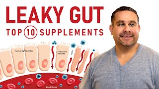 The Top 10 Supplements to Take for Leaky Gut — Dr Salamay [upl. by Adnauqal]